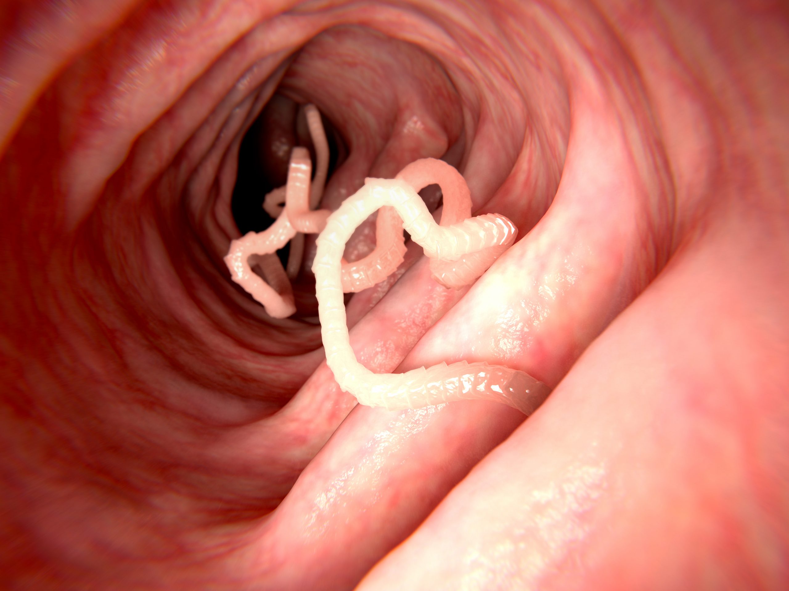 Parasiten Bandwurm im Darm